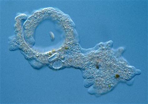  Kentrogon! A Microscopic Blob That Masters Cell Division and Engulfs Food With Pseudopods