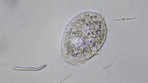  Yоuтhful Yonnellia: A Tiny Ciliate With an Appetite for Decay!